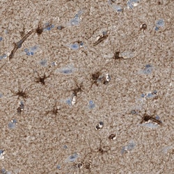 Invitrogen Septin 2 Polyclonal Antibody 100 &mu;L; Unconjugated:Antibodies,