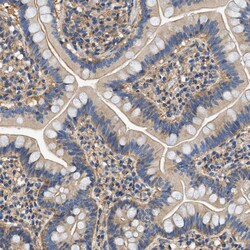 Invitrogen Septin 2 Polyclonal Antibody 100 &mu;L; Unconjugated:Antibodies,
