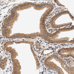 Invitrogen Septin 2 Polyclonal Antibody 100 &mu;L; Unconjugated:Antibodies,