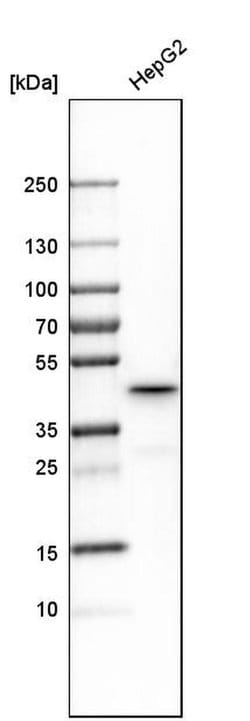 Invitrogen Septin 2 Polyclonal Antibody 100 &mu;L; Unconjugated:Antibodies,