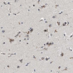 PDP1 Polyclonal Antibody, Invitrogen 100 &mu;L; Unconjugated:Antibodies,