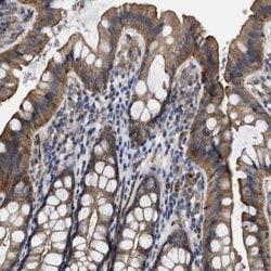 Invitrogen USP4 Polyclonal Antibody 100 &mu;L; Unconjugated:Antibodies,
