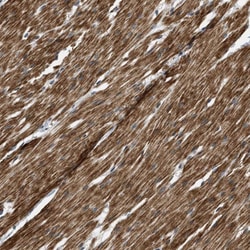 Invitrogen MTMR1 Polyclonal Antibody 100 &mu;L | Buy Online | Invitrogen&trade; | Fisher Scientific