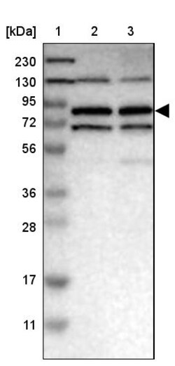 Invitrogen MTMR1 Polyclonal Antibody 100 &mu;L | Buy Online | Invitrogen&trade; | Fisher Scientific