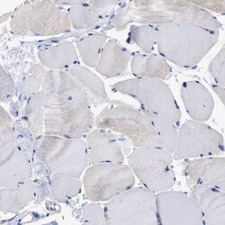 Invitrogen Lrmp Polyclonal Antibody 100 &mu;L; Unconjugated:Antibodies,