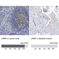Invitrogen Lrmp Polyclonal Antibody 100 &mu;L; Unconjugated:Antibodies,
