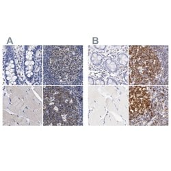 Invitrogen Lrmp Polyclonal Antibody 100 &mu;L; Unconjugated:Antibodies,