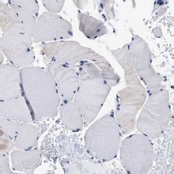 Invitrogen Lrmp Polyclonal Antibody 100 &mu;L; Unconjugated:Antibodies,