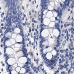 Invitrogen Lrmp Polyclonal Antibody 100 &mu;L; Unconjugated:Antibodies,