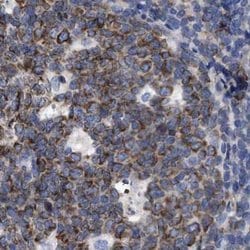 Invitrogen Lrmp Polyclonal Antibody 100 &mu;L; Unconjugated:Antibodies,