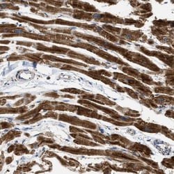 Invitrogen KNP-I Polyclonal Antibody 100 &mu;L; Unconjugated:Antibodies,