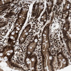Invitrogen RFX5 Polyclonal Antibody 100 &mu;L; Unconjugated:Antibodies,