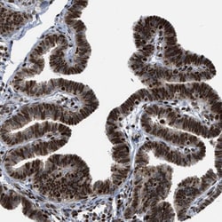 Invitrogen RFX5 Polyclonal Antibody 100 &mu;L; Unconjugated:Antibodies,