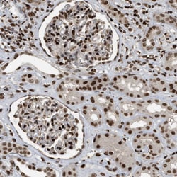 Invitrogen RFX5 Polyclonal Antibody 100 &mu;L; Unconjugated:Antibodies,