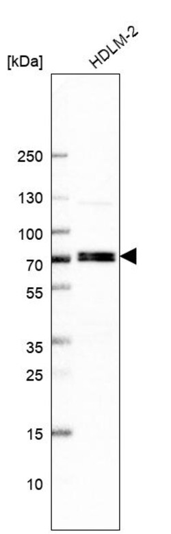 Invitrogen RFX5 Polyclonal Antibody 100 &mu;L | Buy Online | Invitrogen&trade; | Fisher Scientific