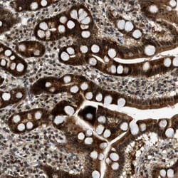 Invitrogen WRB Polyclonal Antibody 100 &mu;L | Buy Online | Invitrogen&trade; | Fisher Scientific