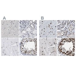 Invitrogen SFRS15 Polyclonal Antibody 100 &mu;L; Unconjugated:Antibodies,