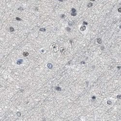 Invitrogen SFRS15 Polyclonal Antibody 100 &mu;L; Unconjugated:Antibodies,