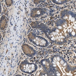 Invitrogen BCL7C Polyclonal Antibody 100 &mu;L; Unconjugated:Antibodies,