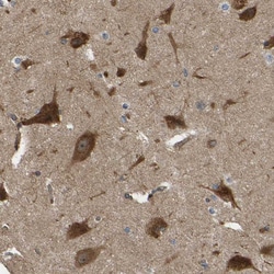 Invitrogen RASGRF2 Polyclonal Antibody 100 &mu;L; Unconjugated:Antibodies,