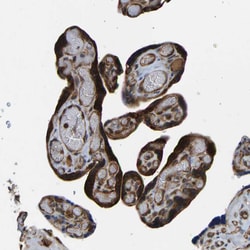 Invitrogen RASGRF2 Polyclonal Antibody 100 &mu;L; Unconjugated:Antibodies,