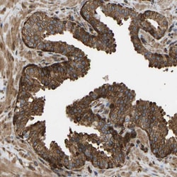 Invitrogen RASGRF2 Polyclonal Antibody 100 &mu;L; Unconjugated:Antibodies,