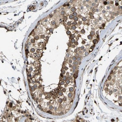 Invitrogen RASGRF2 Polyclonal Antibody 100 &mu;L; Unconjugated:Antibodies,