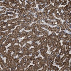 Invitrogen MRPS30 Polyclonal Antibody 100 &mu;L | Buy Online | Invitrogen&trade; | Fisher Scientific