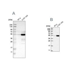 Invitrogen PDLIM7 Polyclonal Antibody 100 &mu;L | Buy Online | Invitrogen&trade; | Fisher Scientific