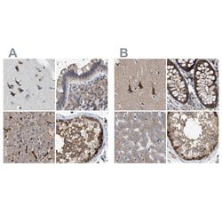 Invitrogen GCN1L1 Polyclonal Antibody 100 &mu;L; Unconjugated:Antibodies,