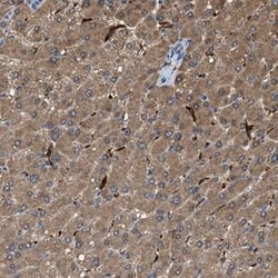 Invitrogen GCN1L1 Polyclonal Antibody 100 &mu;L; Unconjugated:Antibodies,