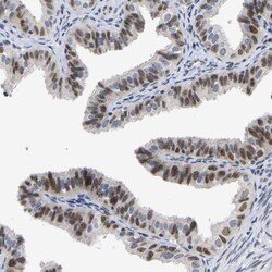 Invitrogen NLE1 Polyclonal Antibody 100 &mu;L; Unconjugated:Antibodies,