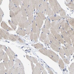 Invitrogen NLE1 Polyclonal Antibody 100 &mu;L; Unconjugated:Antibodies,