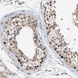 Invitrogen NLE1 Polyclonal Antibody 100 &mu;L; Unconjugated:Antibodies,