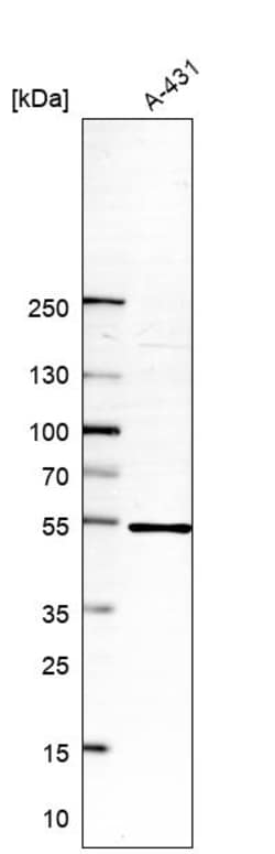 Invitrogen NLE1 Polyclonal Antibody 100 &mu;L | Buy Online | Invitrogen&trade; | Fisher Scientific