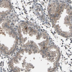 Invitrogen SLC43A1 Polyclonal Antibody 100 &mu;L; Unconjugated:Antibodies,