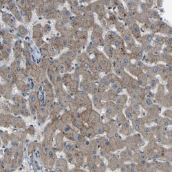 Invitrogen SLC43A1 Polyclonal Antibody 100 &mu;L; Unconjugated:Antibodies,