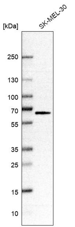 Invitrogen SLC43A1 Polyclonal Antibody 100 &mu;L | Buy Online | Invitrogen&trade; | Fisher Scientific