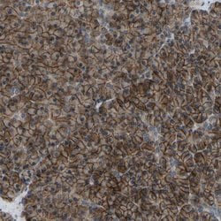Invitrogen SLC43A1 Polyclonal Antibody 100 &mu;L; Unconjugated:Antibodies,