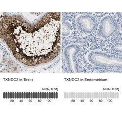 Invitrogen TXNDC2 Polyclonal Antibody 100 &mu;L; Unconjugated:Antibodies,