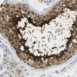 Invitrogen TXNDC2 Polyclonal Antibody 100 &mu;L; Unconjugated:Antibodies,