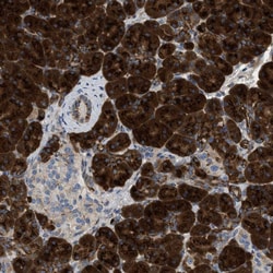 Invitrogen ZNF70 Polyclonal Antibody 100 &mu;L; Unconjugated:Antibodies,