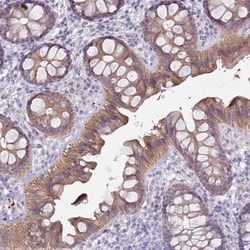 Invitrogen C15orf2 Polyclonal Antibody 100 &mu;L; Unconjugated:Antibodies,