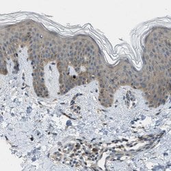 Invitrogen EDARADD Polyclonal Antibody 100 &mu;L; Unconjugated:Antibodies,