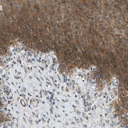 Invitrogen EDARADD Polyclonal Antibody 100 &mu;L; Unconjugated:Antibodies,