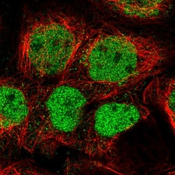 Invitrogen GPATCH2L Polyclonal Antibody 100 &mu;L; Unconjugated:Antibodies,