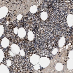 Invitrogen GPATCH2L Polyclonal Antibody 100 &mu;L; Unconjugated:Antibodies,