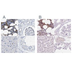 Invitrogen SERPINB1 Polyclonal Antibody 100 &mu;L; Unconjugated:Antibodies,