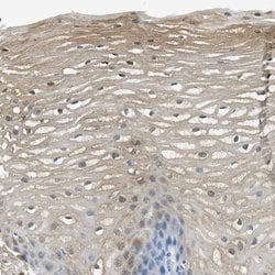 Invitrogen SERPINB1 Polyclonal Antibody 100 &mu;L; Unconjugated:Antibodies,