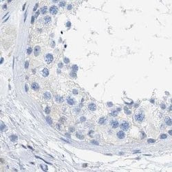 Invitrogen SERPINB1 Polyclonal Antibody 100 &mu;L; Unconjugated:Antibodies,